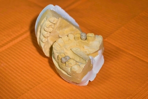 Повече за  избелване на зъби 34