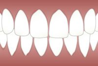 Ефектни зъбни импланти 5
