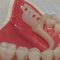 Типове детски зъболекар софия 27