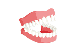 Information about Dental Implants 14