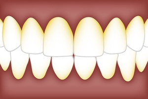 Select Dental Implants 22